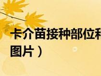卡介苗接種部位和途徑視頻（卡介苗接種成功圖片）