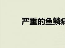 嚴重的魚鱗病圖片（魚鱗病圖片）