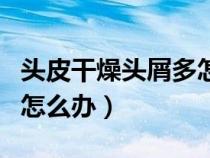 頭皮干燥頭屑多怎么辦女性（頭皮干燥頭屑多怎么辦）