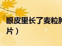 眼皮里長了麥粒腫怎么辦（眼睛長了麥粒腫圖片）