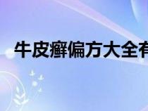 牛皮癬偏方大全有哪些（牛皮癬偏方大全）
