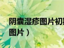 陰囊濕疹圖片初期癥狀圖片 男性（陰囊濕疹圖片）