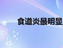 食道炎最明顯的癥狀有哪些（食女）