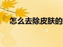 怎么去除皮膚的螨蟲（怎樣去皮膚螨蟲）