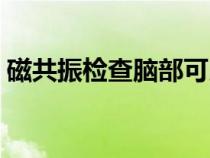 磁共振檢查腦部可以看出哪些問(wèn)題（磁共振）