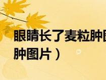 眼睛長了麥粒腫圖片怎么辦?(眼睛長了麥粒腫圖片) 眼睛長了麥粒腫圖片怎么辦?(眼睛長了麥粒腫圖片)